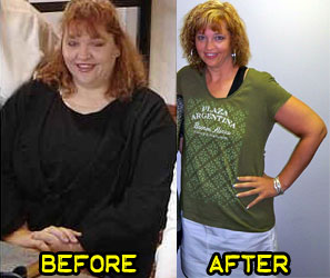 florence-weight-loss-story-2