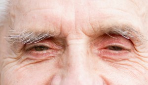 Common eye problems and diseases in aging adults