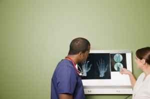 Lupus (SLE) raises osteoporosis bone fracture risk